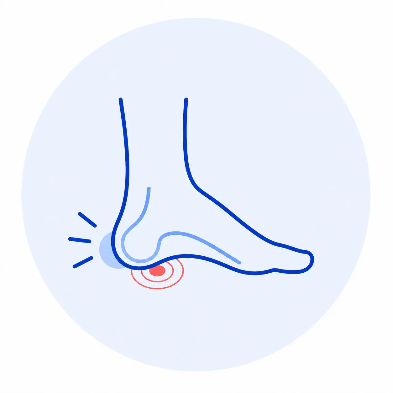 Hamstring